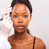 Baltimore Medical Malpractice Lawyers weigh in on cosmetic surgery errors. 