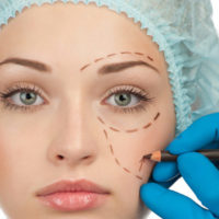Baltimore Medical Malpractice Lawyers weigh in on choosing the right cosmetic surgeon.